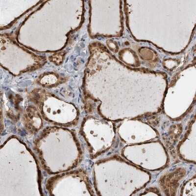 Immunohistochemistry-Paraffin: USH1G Antibody [NBP1-89076]