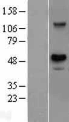 Western Blot: USH1G Overexpression Lysate [NBL1-17639]