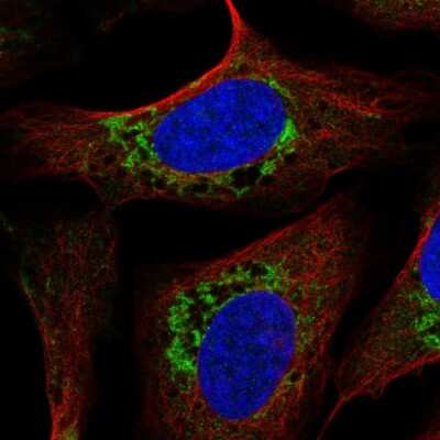 Immunocytochemistry/ Immunofluorescence: USMG5 Antibody [NBP2-55149]