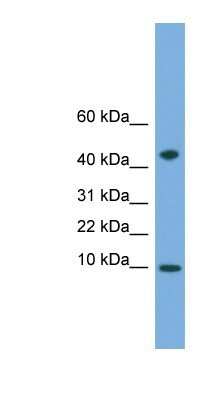 Western Blot: USMG5 Antibody [NBP1-91361]