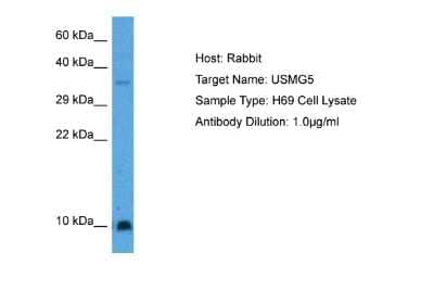 Western Blot: USMG5 Antibody [NBP1-91361]