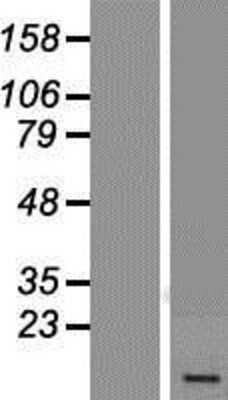 Western Blot: USMG5 Overexpression Lysate [NBP2-05974]