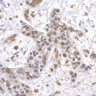 Immunohistochemistry-Paraffin: USP1 Antibody [NB100-88117]