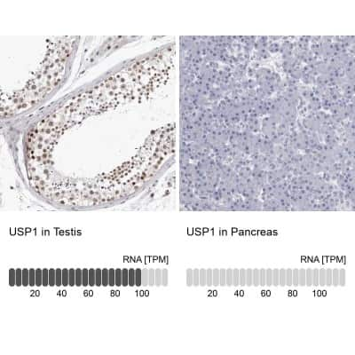 Immunohistochemistry-Paraffin: USP1 Antibody [NBP1-85950]