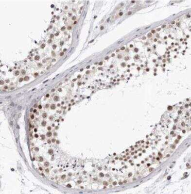 Immunohistochemistry-Paraffin: USP1 Antibody [NBP1-85950]