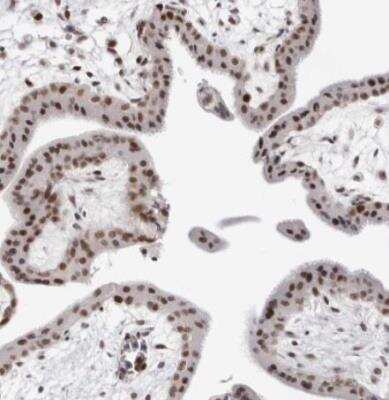 Immunohistochemistry-Paraffin: USP1 Antibody [NBP1-85950]