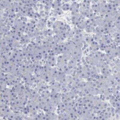 Immunohistochemistry-Paraffin: USP1 Antibody [NBP1-85950]