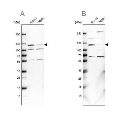 Western Blot: USP1 Antibody [NBP1-85950]