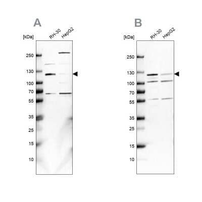 Western Blot: USP1 Antibody [NBP2-55036]