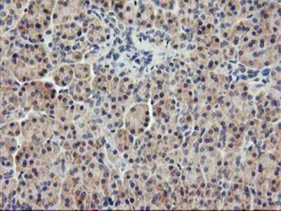 Immunohistochemistry-Paraffin: USP10 Antibody (OTI2E1) [NBP2-01452]