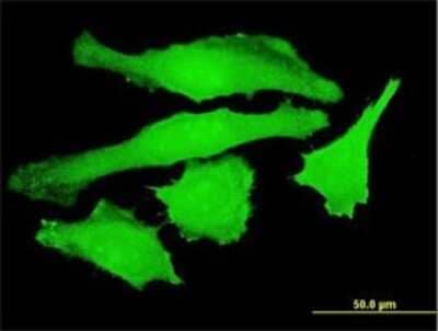 Immunocytochemistry/ Immunofluorescence: USP10 Antibody (3B8) [H00009100-M01]