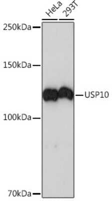 Western Blot: USP10 Antibody (9L6F3) [NBP3-16416]