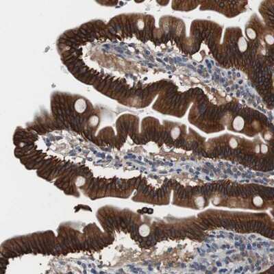 Immunohistochemistry-Paraffin: USP10 Antibody [NBP1-83028]