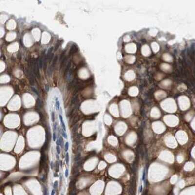 Immunohistochemistry-Paraffin: USP10 Antibody [NBP1-83028]