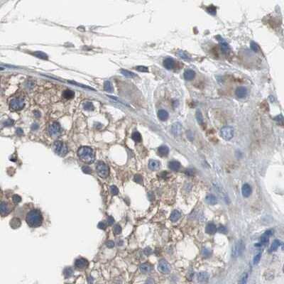 Immunohistochemistry-Paraffin: USP10 Antibody [NBP1-83028]