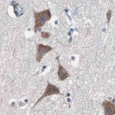 Immunohistochemistry-Paraffin: USP10 Antibody [NBP1-83028]