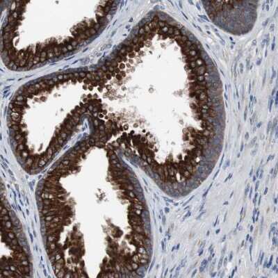 Immunohistochemistry-Paraffin: USP10 Antibody [NBP1-83028]