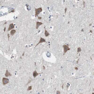 Immunohistochemistry-Paraffin: USP10 Antibody [NBP1-83028]