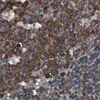 Immunohistochemistry-Paraffin: USP10 Antibody [NBP1-83029]
