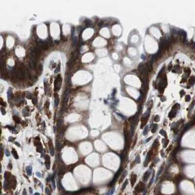 Immunohistochemistry-Paraffin: USP10 Antibody [NBP1-83029]
