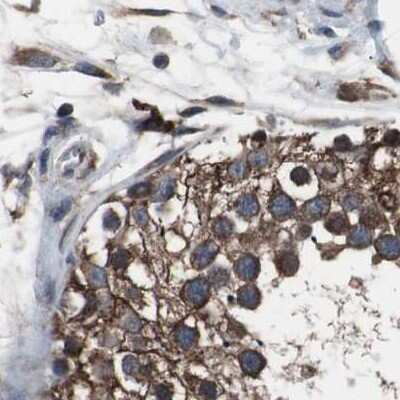 Immunohistochemistry-Paraffin: USP10 Antibody [NBP1-83029]