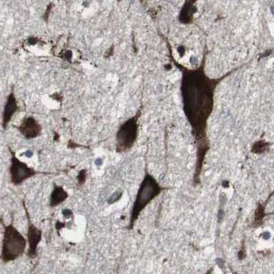Immunohistochemistry-Paraffin: USP10 Antibody [NBP1-83029]
