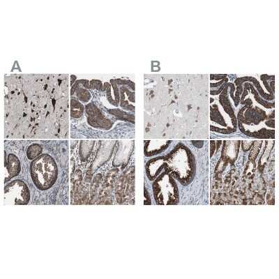 Immunohistochemistry-Paraffin: USP10 Antibody [NBP1-83029]