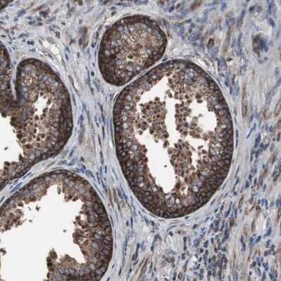 Immunohistochemistry-Paraffin: USP10 Antibody [NBP1-83029]