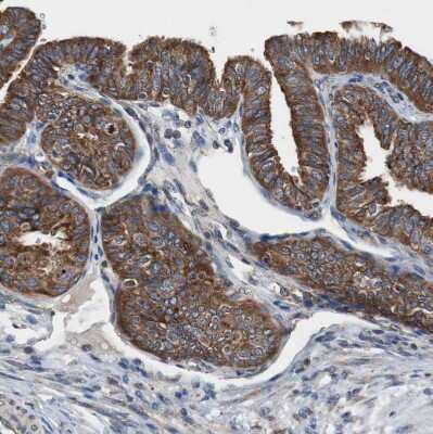 Immunohistochemistry-Paraffin: USP10 Antibody [NBP1-83029]