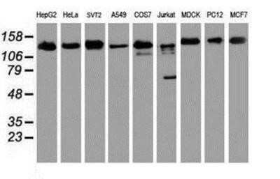 Western Blot: USP10 Antibody (OTI2E1)Azide and BSA Free [NBP2-74798]