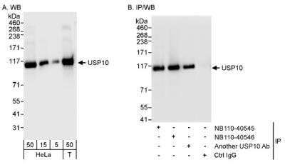 Western Blot: USP10 Antibody [NB110-40545]