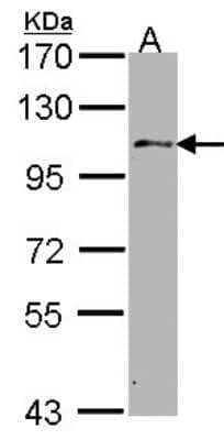 Western Blot: USP10 Antibody [NBP1-33677]