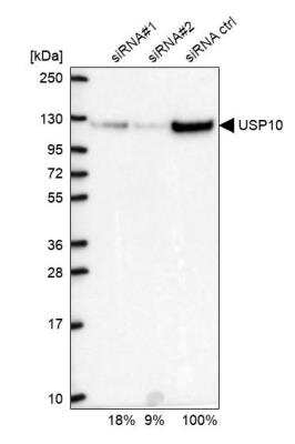 Western Blot: USP10 Antibody [NBP1-83029]