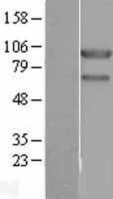 Western Blot: USP10 Overexpression Lysate [NBL1-17643]