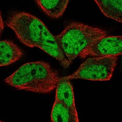 Immunocytochemistry/ Immunofluorescence: USP11 Antibody [NBP1-80640]