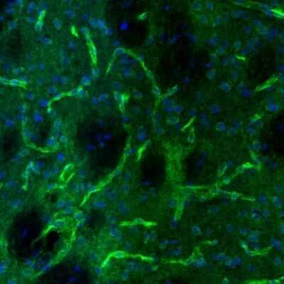 Immunohistochemistry: USP11 Antibody [NBP1-80639]