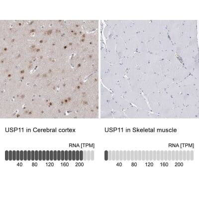 Immunohistochemistry-Paraffin: USP11 Antibody [NBP1-80639]