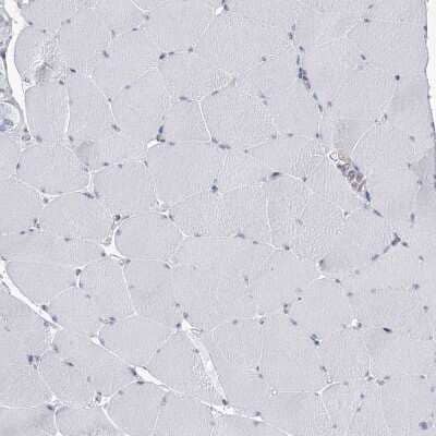 Immunohistochemistry-Paraffin: USP11 Antibody [NBP1-80639]