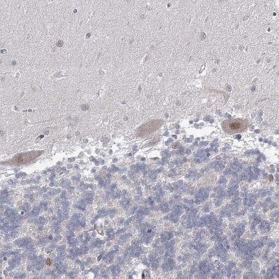 Immunohistochemistry-Paraffin: USP11 Antibody [NBP1-80639]