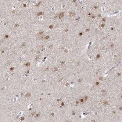 Immunohistochemistry-Paraffin: USP11 Antibody [NBP1-80639]