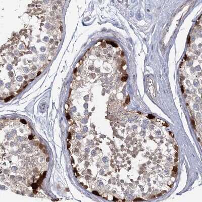 Immunohistochemistry-Paraffin: USP11 Antibody [NBP1-80639]