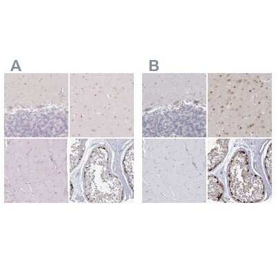 Immunohistochemistry-Paraffin: USP11 Antibody [NBP1-80640]