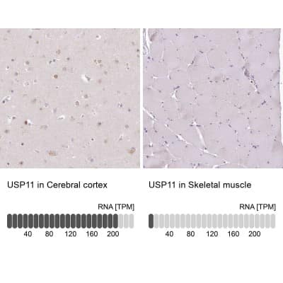Immunohistochemistry-Paraffin: USP11 Antibody [NBP1-80640]
