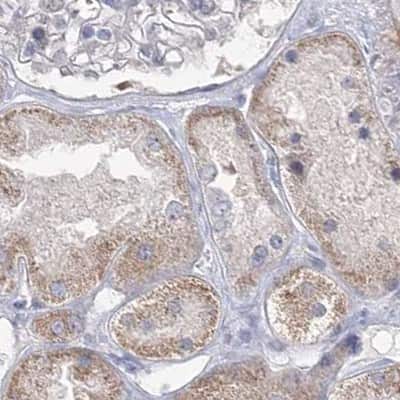 Immunohistochemistry-Paraffin: USP11 Antibody [NBP1-80640]