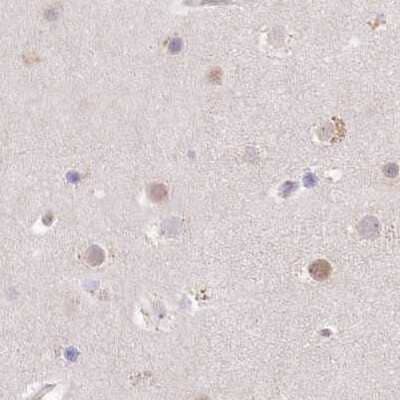 Immunohistochemistry-Paraffin: USP11 Antibody [NBP1-80640]