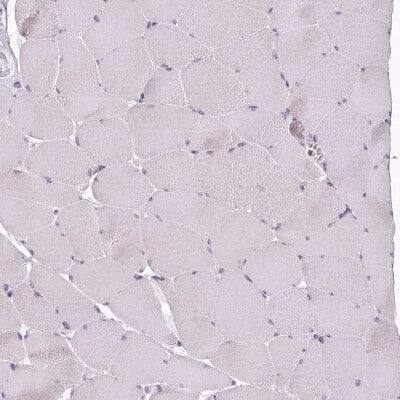 Immunohistochemistry-Paraffin: USP11 Antibody [NBP1-80640]