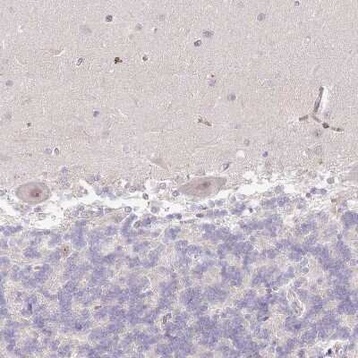 Immunohistochemistry-Paraffin: USP11 Antibody [NBP1-80640]