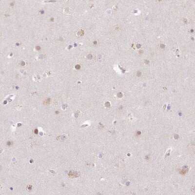 Immunohistochemistry-Paraffin: USP11 Antibody [NBP1-80640]