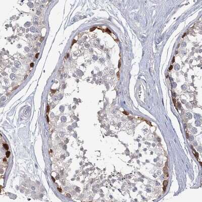 Immunohistochemistry-Paraffin: USP11 Antibody [NBP1-80640]