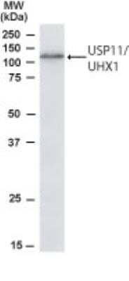 Western Blot: USP11 Antibody [NB100-1251]